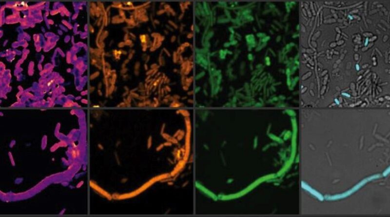 This shows the chemical profiles of the microbiome.