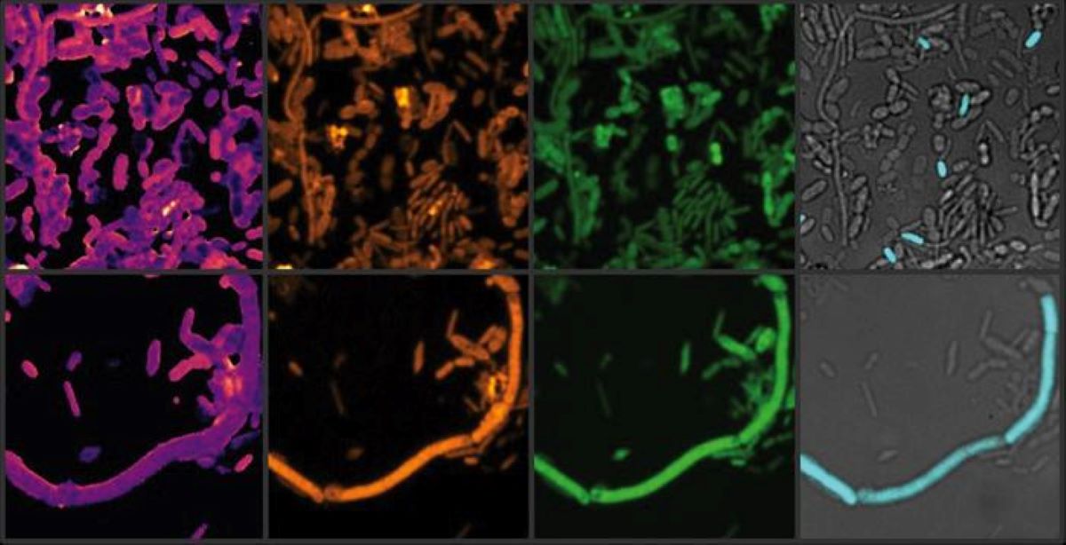 This shows the chemical profiles of the microbiome.